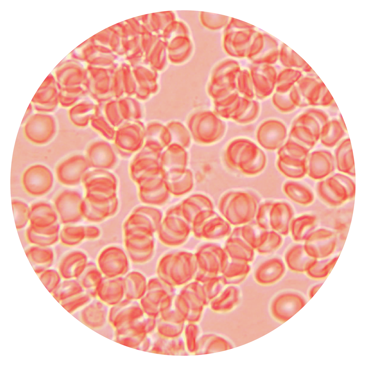 Live Blood Analysis – b.wellness